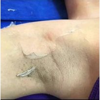 5 Chai lột tái tạo sinh học NN collagen