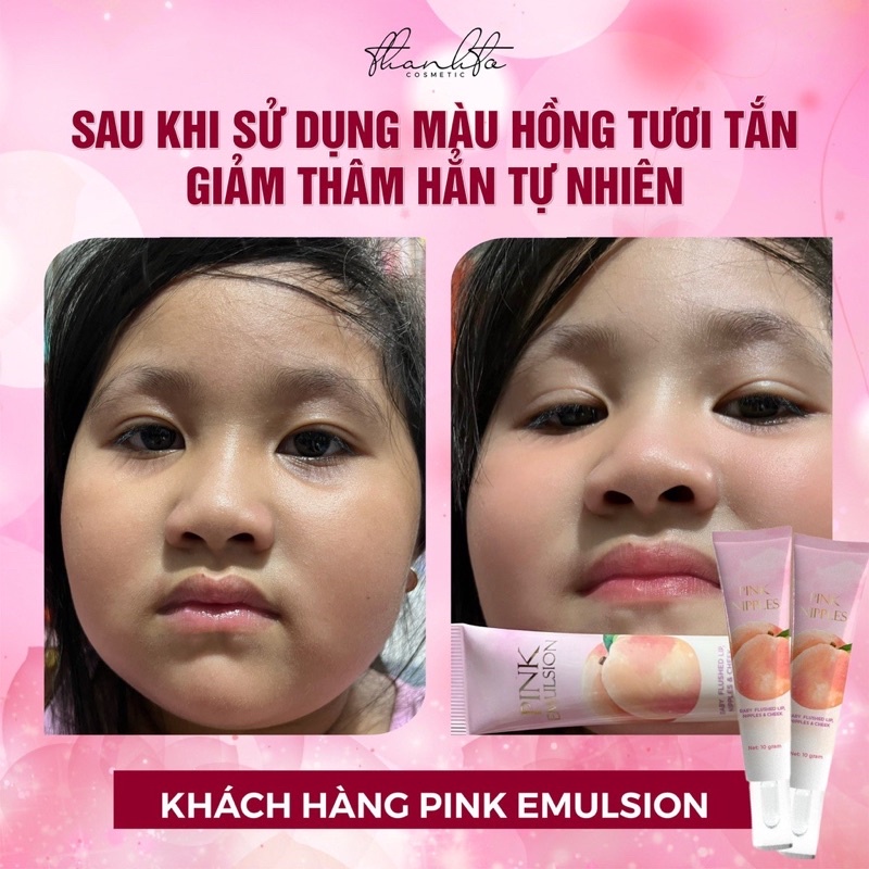 Kem Dưỡng Má Hồng Môi - Ti Hồng Thanh Tô - Pink Emulsion ( Chính Hãng 100%)