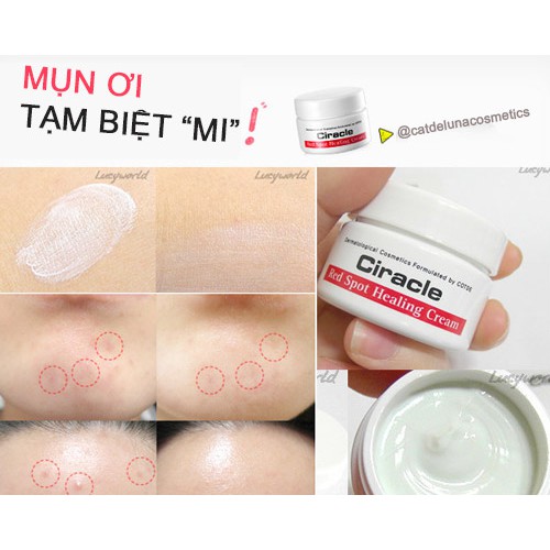 KEM GIẢM MỤN GIẢM THÂM CIRACLE RED SPOT CREAM CHÍNH HÃNG