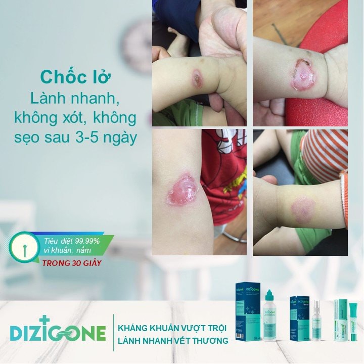 [COMBO] - Dizigone 300ml &amp; Dizigone spray 100ml - kháng khuẩn, rửa vết thương ngoài da