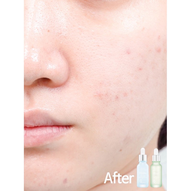 Tinh Chất Dưỡng Da 9Wishes Ampoule Serum