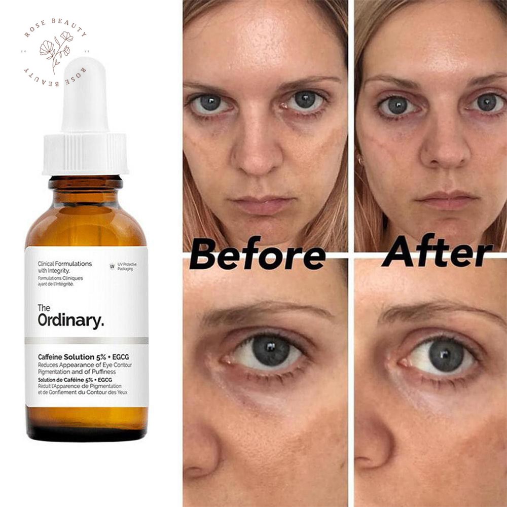 (BILL CANADA) Serum The Ordinary Serum Caffeine Solution 5% + EGCG 30ml dưỡng mắt giảm quầng thâm mắt ROSE Beauty | BigBuy360 - bigbuy360.vn