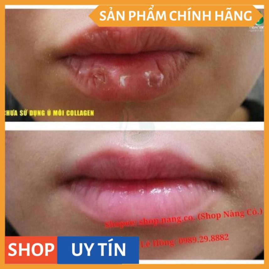 SON Ủ MÔI SHI - MỀN MÔI -DƯỠNG MÔI - HỒNG MÔI - TRỊ THÂM MÔI V V V | Thế Giới Skin Care