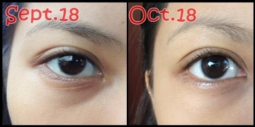 Kem ngừa thâm mắt Kumargic nhật bản | BigBuy360 - bigbuy360.vn