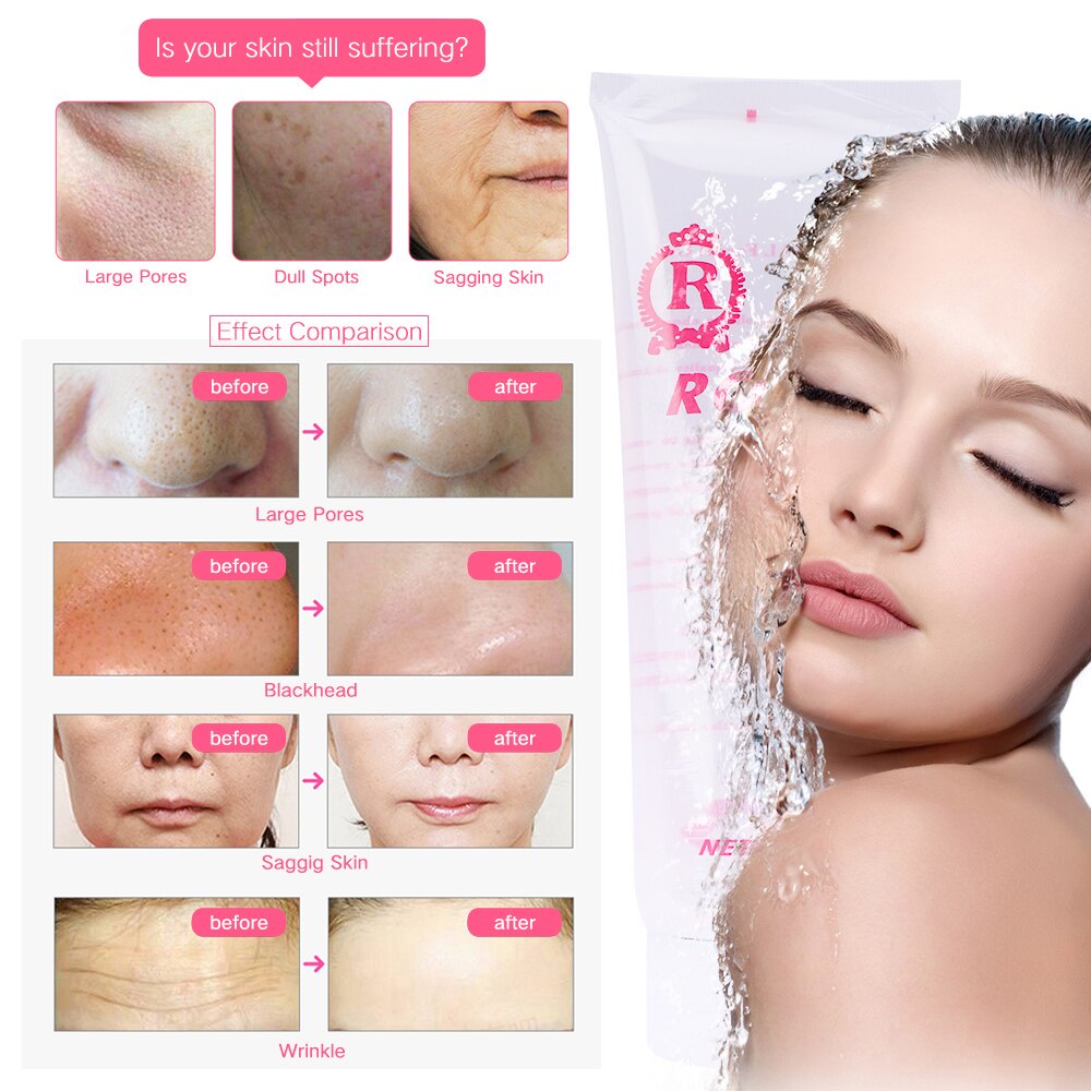 Kem gel dưỡng ẩm làm trắng và săn chắc da mặt bằng sóng siêu âm SALORIE