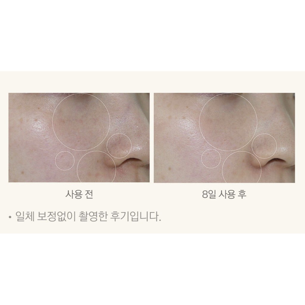 (ĐẠI LÝ CHÍNH HÃNG )-( MẪU MỚI NHẤT) SERUM Varihope 8 Days Pure Vitamin C Ampoule - Tinh chất Vitamin C | BigBuy360 - bigbuy360.vn