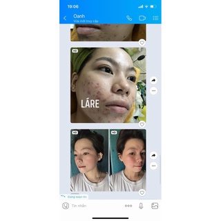 SERUM LÁRE THANH DƯỢC - SIZE 50ML