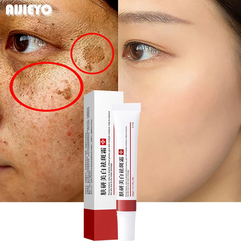 Kem Hỗ trợ giảm nám Tàn Nhang Làm Trắng Da Chống Lão Hóa Hiệu Quả ointment