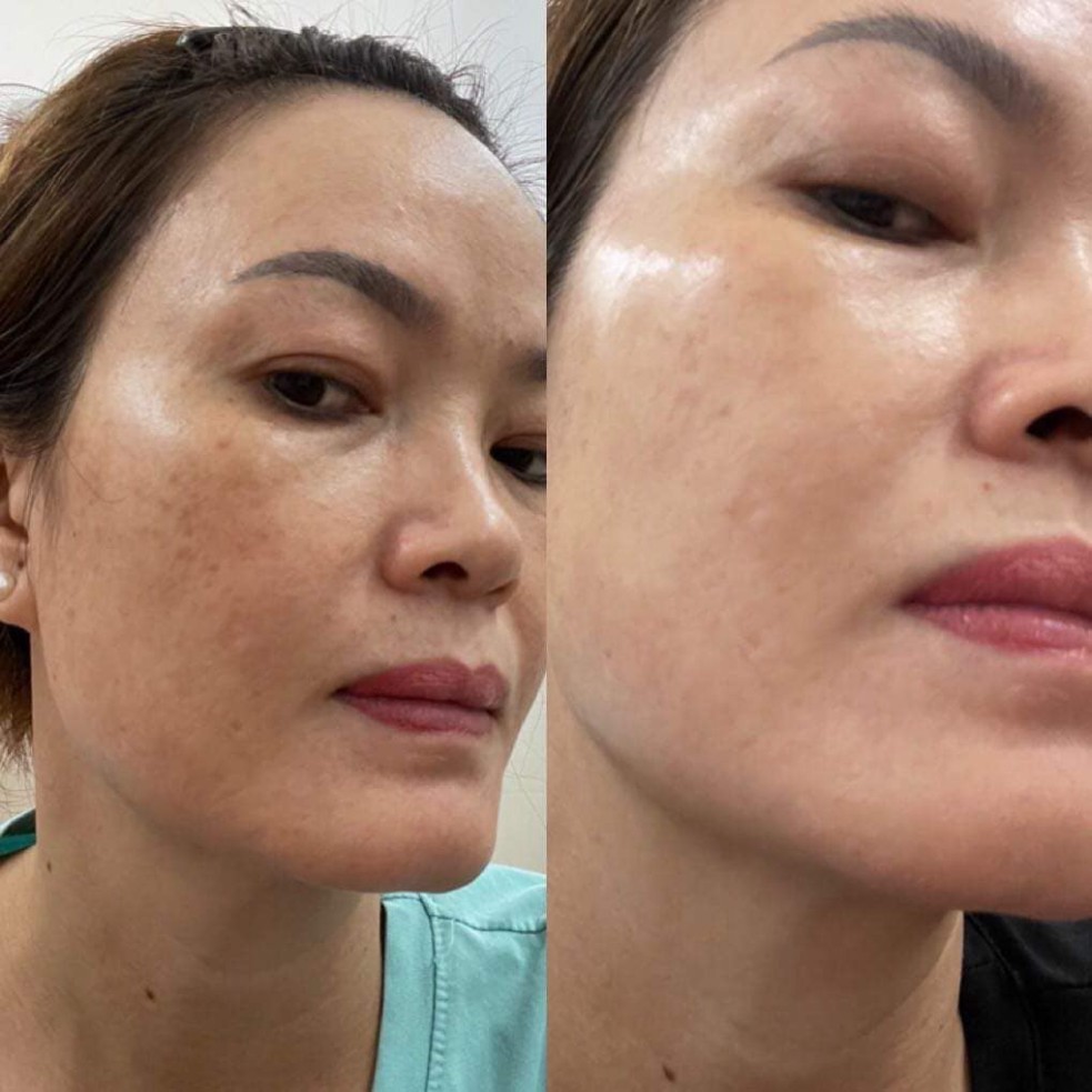 Cao Nám Insam Dr Cell, Kem Nám Hiệu Quả Giúp Làm Mờ Thâm Nám Da, Sạm Da, Tàn Nhang, Chông Lõa Hóa Da, 20ml Chính Hãng | BigBuy360 - bigbuy360.vn