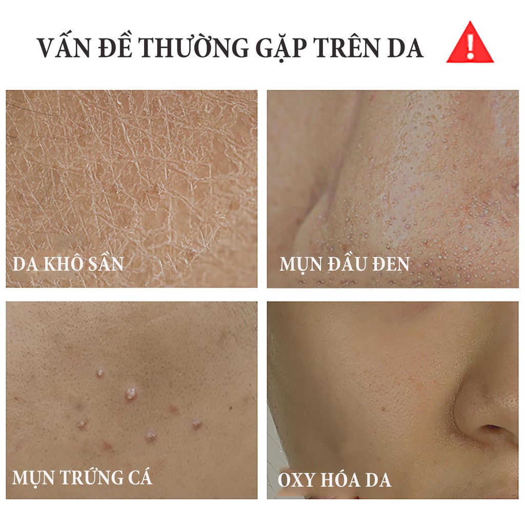 Bộ Sữa Rửa Mặt Ngày Đêm Cao Cấp CIYAOO 💝FREESHIP💝 Dưỡng ẩm, Trắng da và Ngừa mụn (100g x 2chai) QX0010 | BigBuy360 - bigbuy360.vn