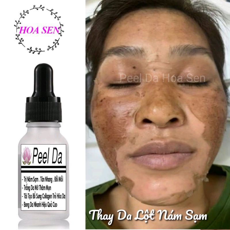 Peel Tái Tạo Trắng Da Hết Nám Lột Nhanh Sau 7 Tiếng | BigBuy360 - bigbuy360.vn