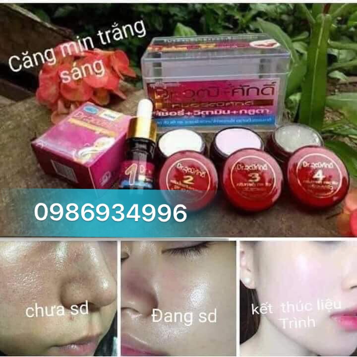 Chính hãng] Bộ Mỹ Phẩm Nám thái đỏ | BigBuy360 - bigbuy360.vn