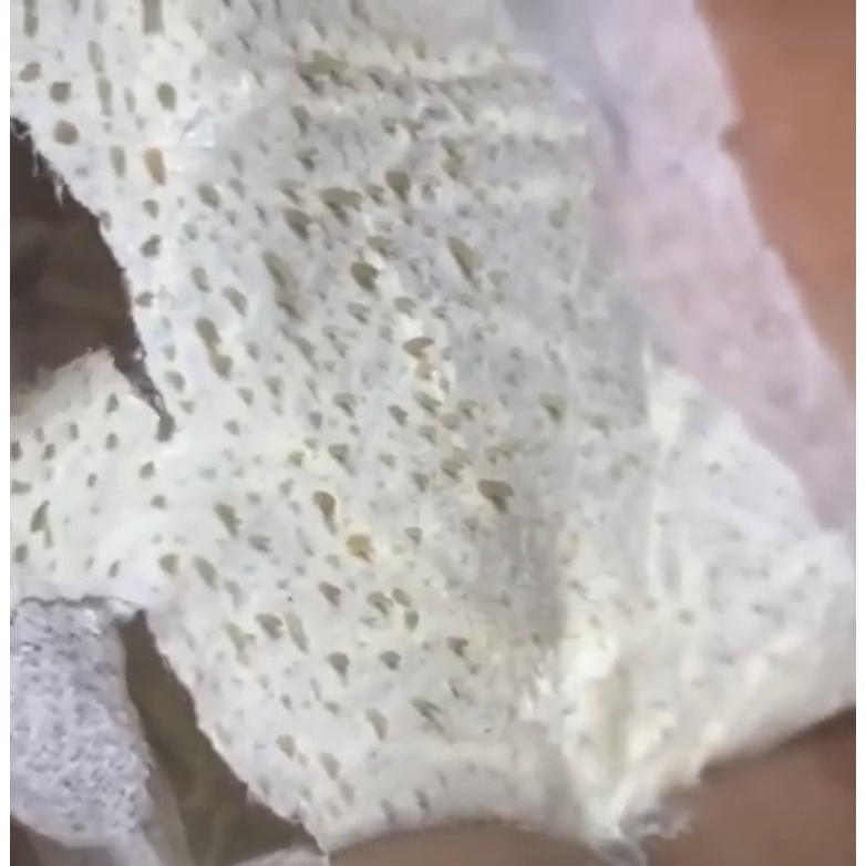 Gel Hút Mụn, Gel Lột Mụn Aloe Facial Clear Mask Thái Lan 22gram