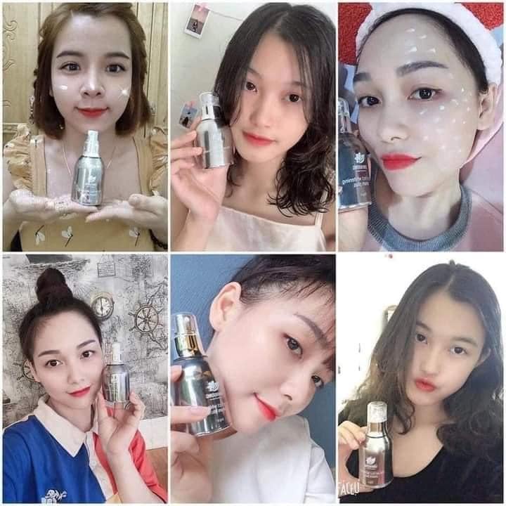 Kem Sữa Dưỡng Trắng Da Mặt, Cấp Ẩm, Ngừa Lão Hóa, Cân Bằng Da The Perfect Whitening Cream Plus Chính Hãng Linh Hương 30m