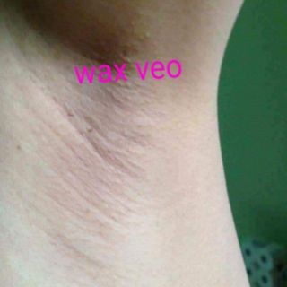 Combo wax lông + mỡ trăn triệt lông