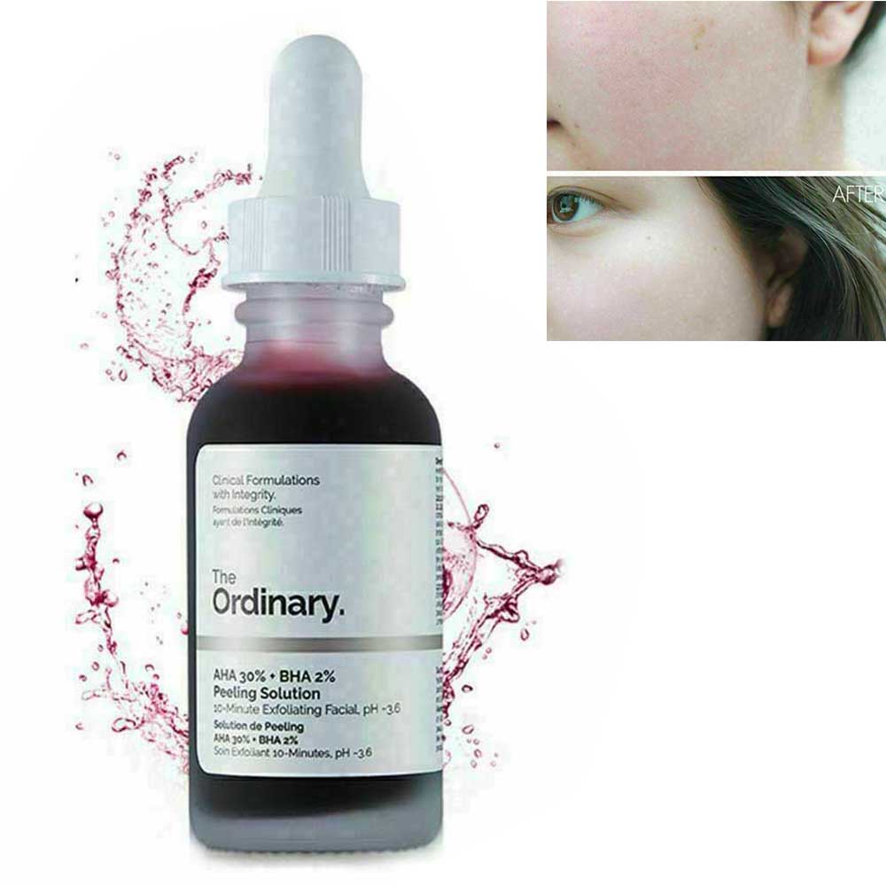 The Ordinary 30% AHA Salicylic Acid Essence Exfoliating Peel Closed Mouth Brush Body Acne Marks