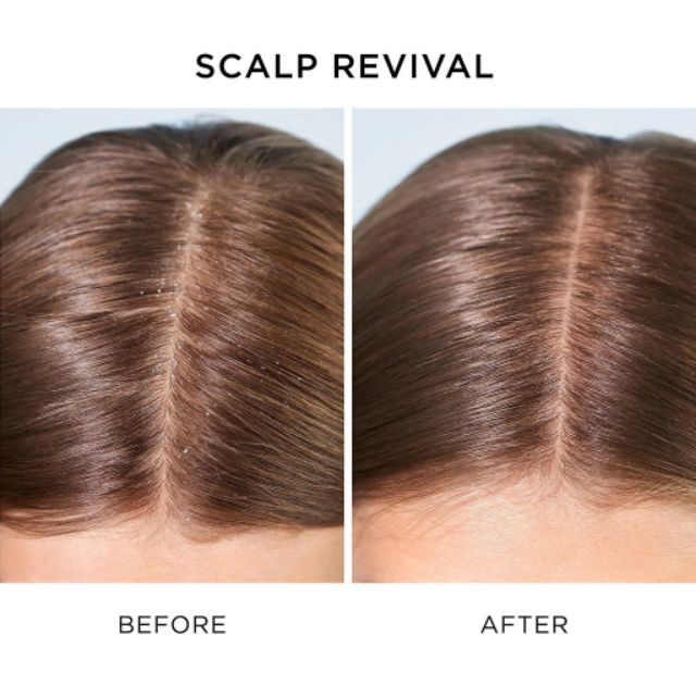 Dầu gội giảm gàu, tẩy tế bào chết cho tóc #Briogeo Scalp Revival™ Charcoal + Coconut Oil Micro-Exfoliating Shampoo