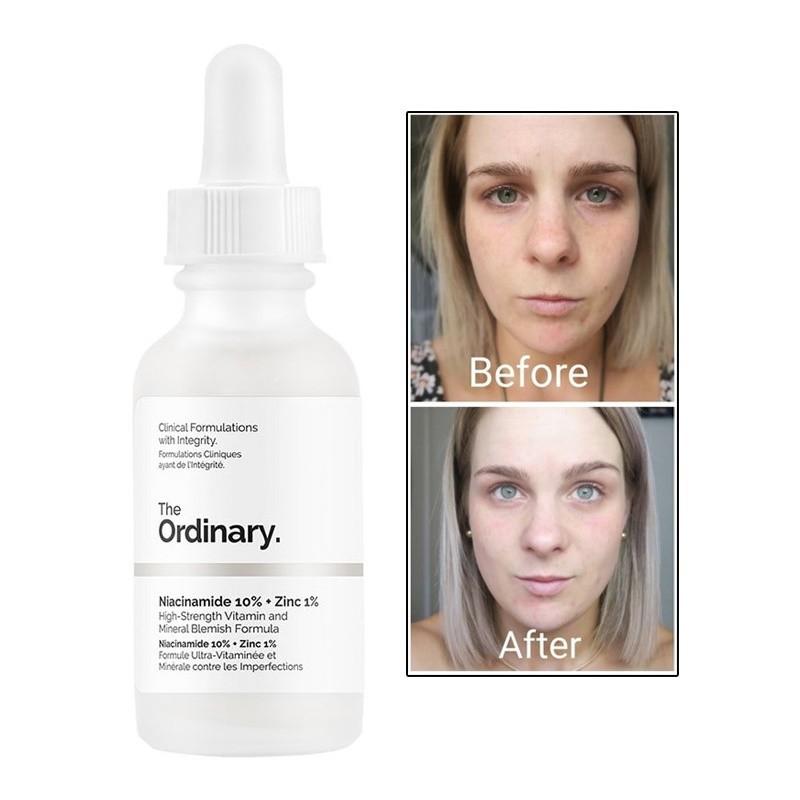 Tinh chất Niacinamide 10% + Zinc 1% - The Ordinary