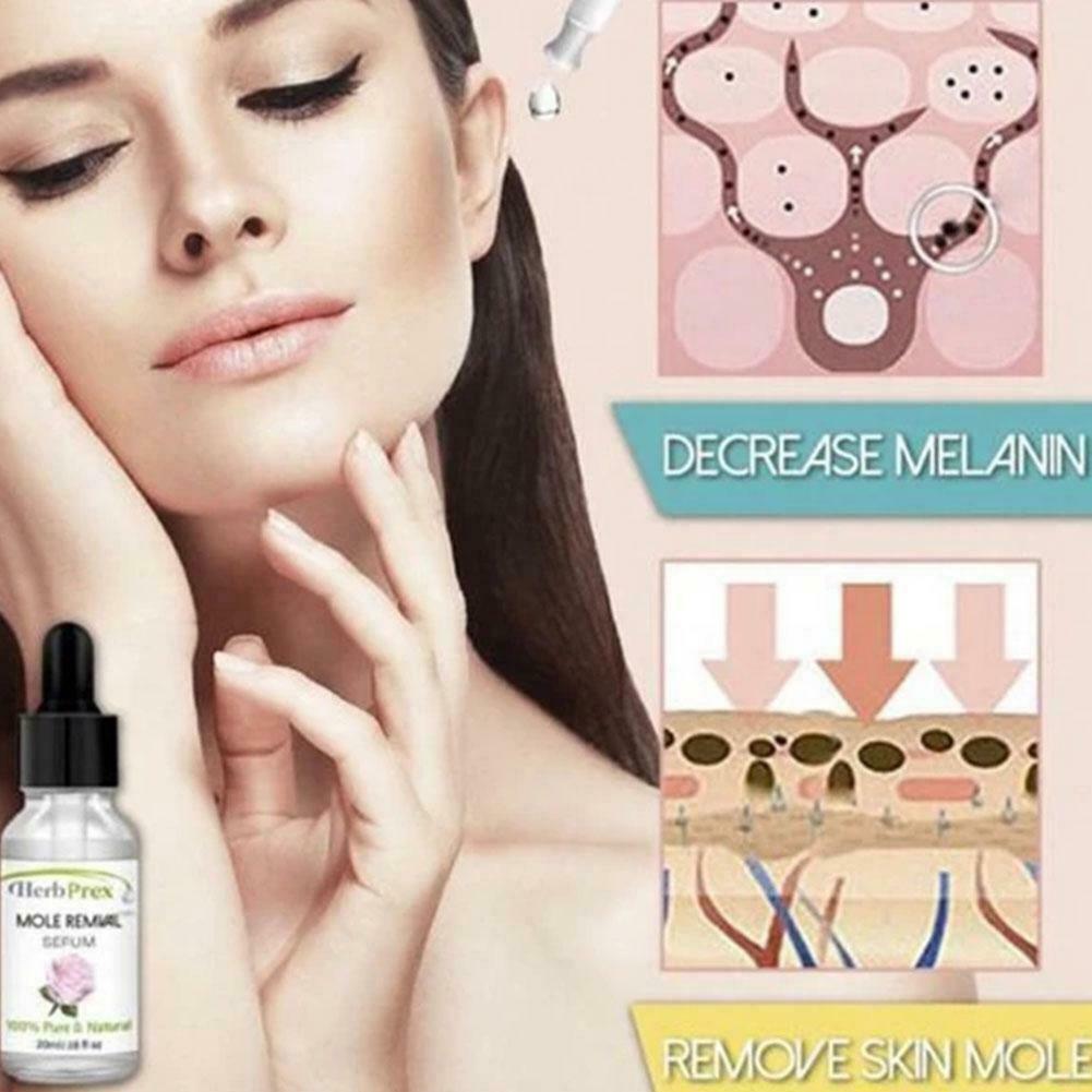 (Hàng Mới Về) Tinh Dầu Hữu Cơ 20ml Loại Bỏ Nốt Ruồi Hiệu Quả P6Q0 | BigBuy360 - bigbuy360.vn