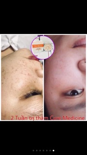 Cao thâm fourets cosmetics