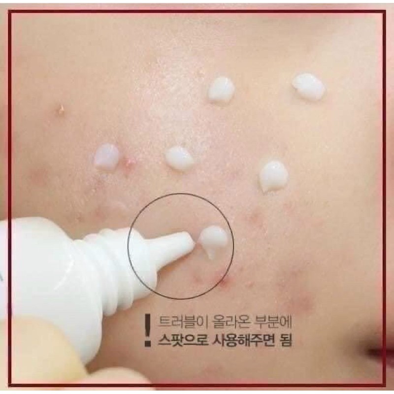 Kem Chấm Mụn Innisfree Bija Cica Ex Chính Hãng | BigBuy360 - bigbuy360.vn