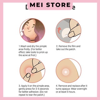 Miếng dán mụn BREYLEE cao cấp
