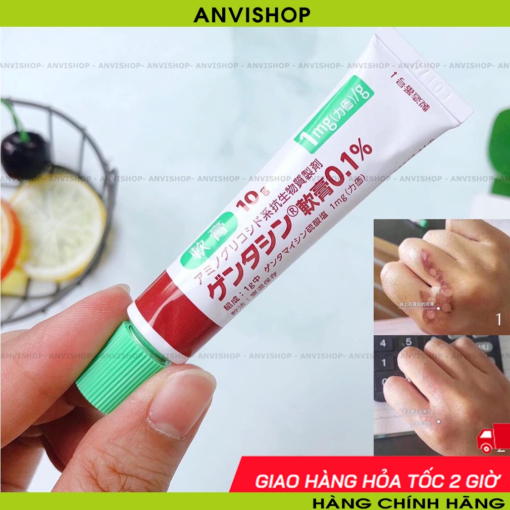 Kem Giảm sẹo Gentacin Nhật Bản 10g (Takata Gentamicine) - 1 tuýp