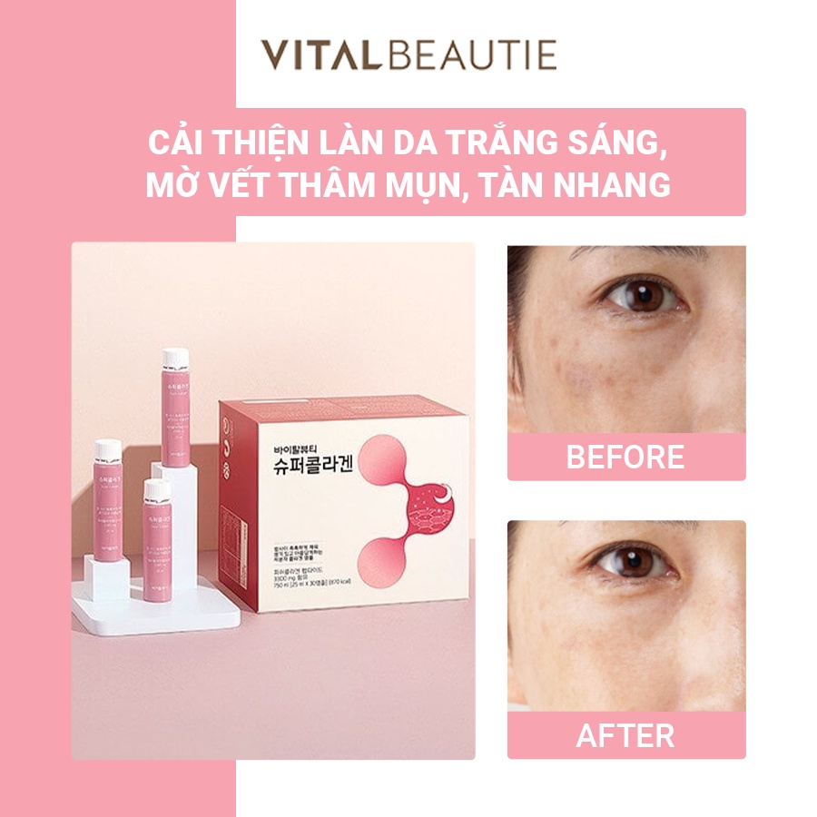 Nước uống Collagen đẹp da  Hàn quốc VB Program Shuper Collagen 3000mg, hàng chính hãng