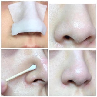 [ cận date ] Ủ mụn Medipeel super extra9 chai 250ml