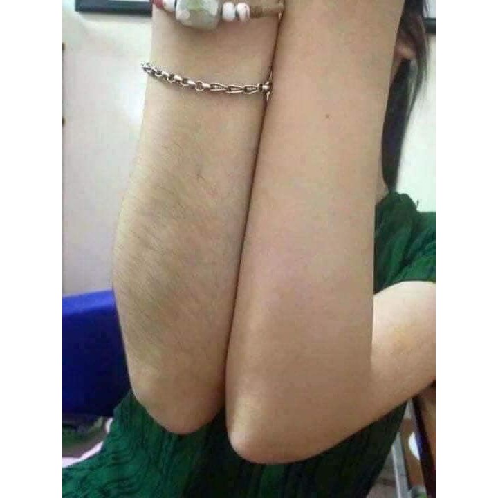 [CHÍNH HÃNG] Kem tẩy lông Kone Thái Lan dọn sạch sẽ mọi loại lông | BigBuy360 - bigbuy360.vn