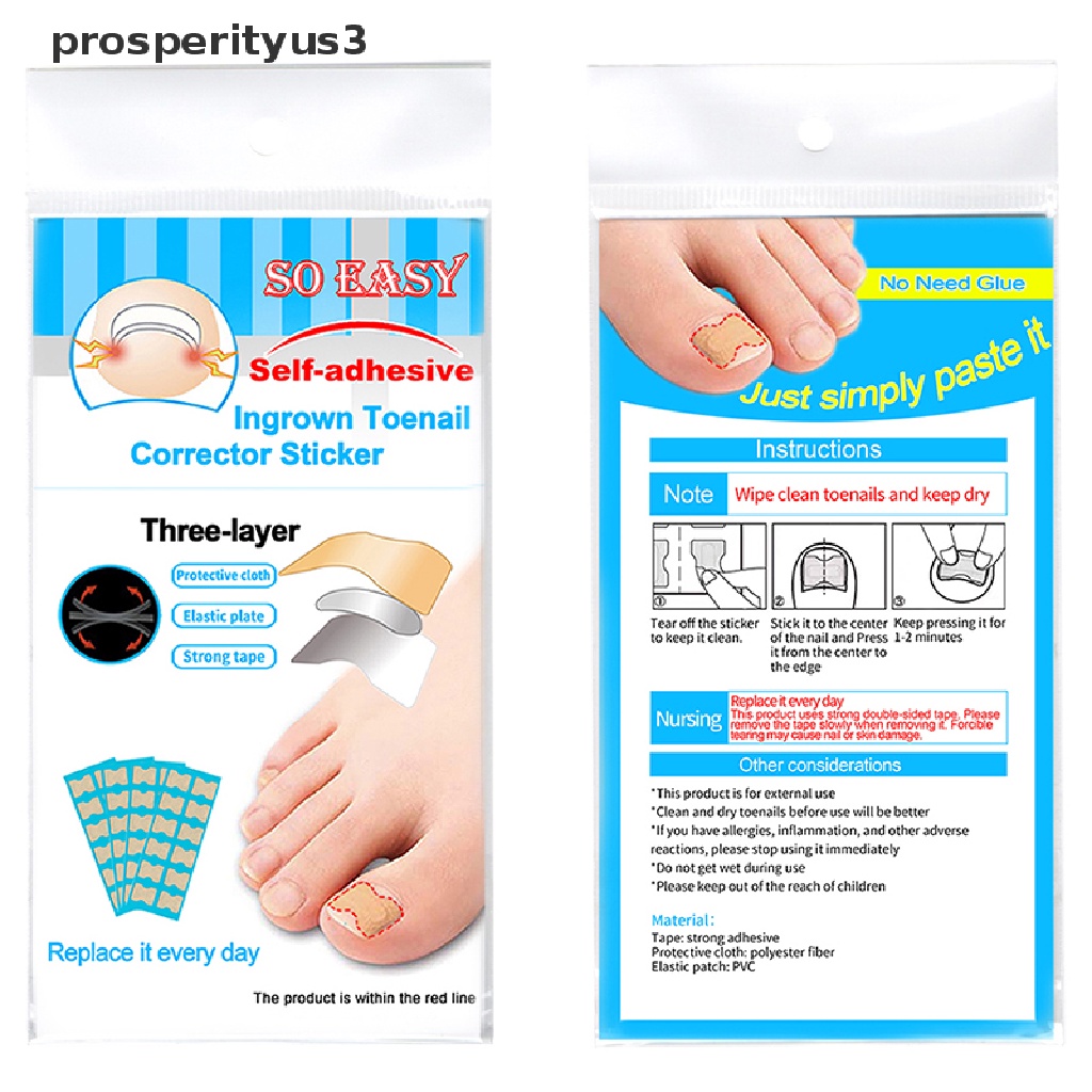 [prosperityus3] Ingrown Toenail Correction Tool Toe Nail Treatment Elastic Patch Sticker Clip [new]