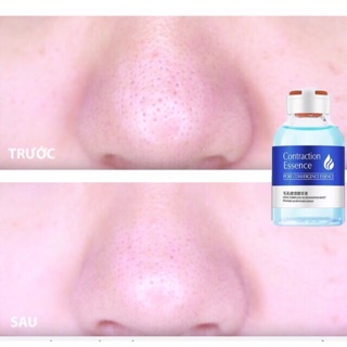 Combo 2 Chai Serum xanh se lỗ chân lông cấp nước cho da