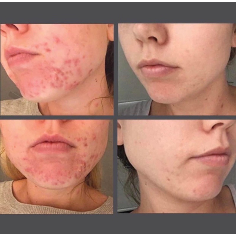 Tinh chất phục hồi dưỡng trắng da Serum ASAP super B complex (hàng cty chính hãng)