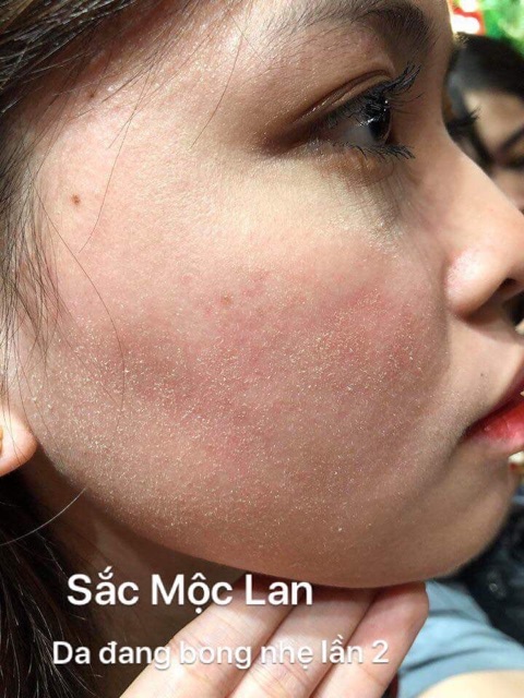 Sắc mộc lan