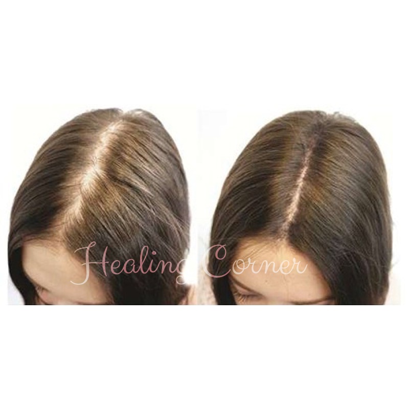 Xịt Kích Mọc Tóc Bồ Kết - Healing Corner