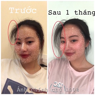 TINH DẦU BƯỞI VIJULLY KÍCH MỌC TÓC