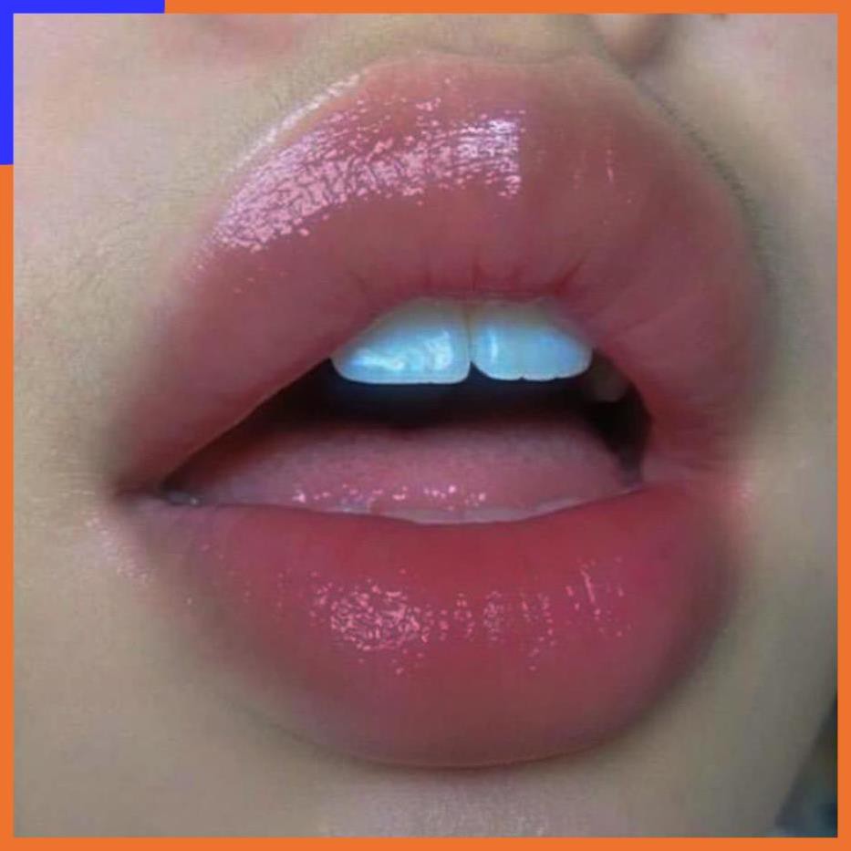 SON Ủ MÔI SHI - MỀN MÔI -DƯỠNG MÔI - HỒNG MÔI - TRỊ THÂM MÔI V V V | Thế Giới Skin Care