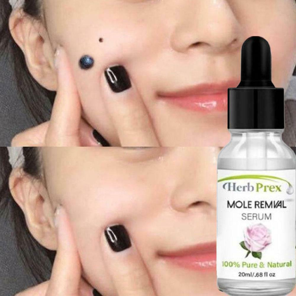 (Hàng Mới Về) Tinh Dầu Hữu Cơ 20ml Loại Bỏ Nốt Ruồi Hiệu Quả P6Q0 | BigBuy360 - bigbuy360.vn
