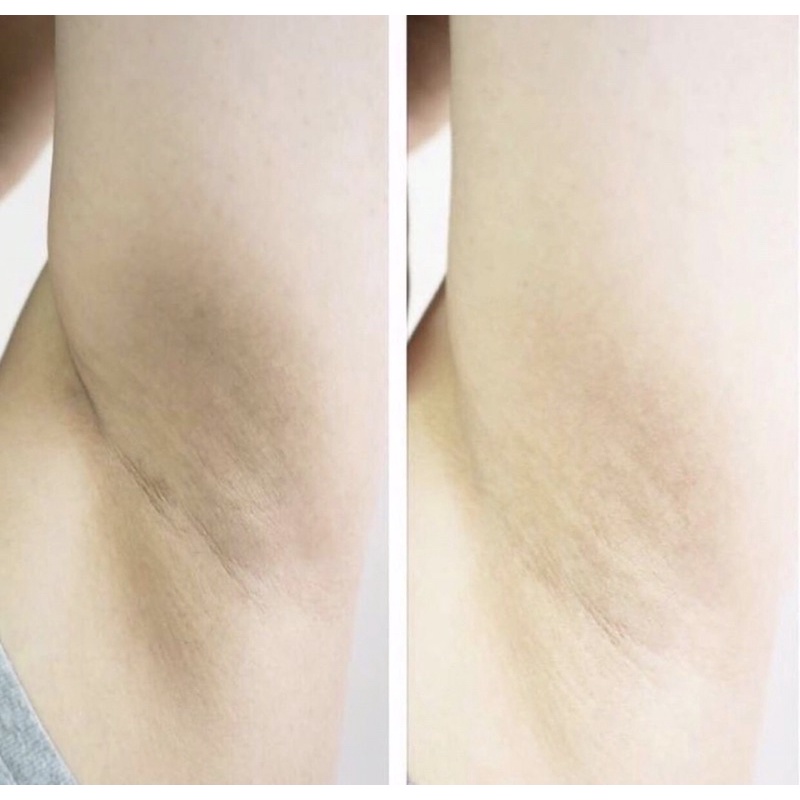 Xà phòng trắng nách Himecoto Shiro Waki Hime