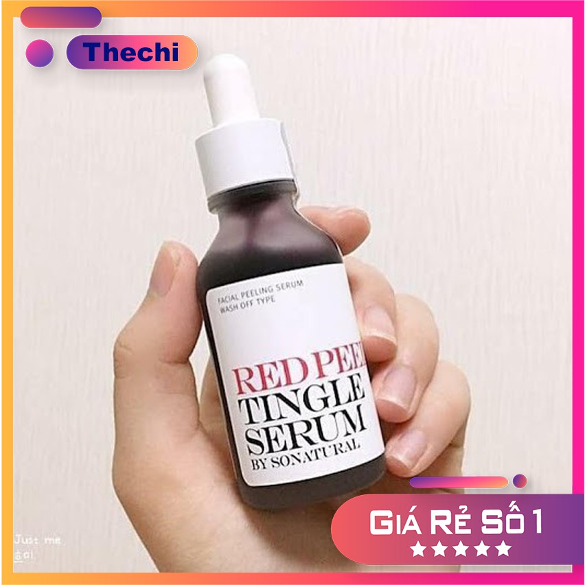 Thay Da Sinh Học Natural Red Peel Tingle Serum 35ml | BigBuy360 - bigbuy360.vn