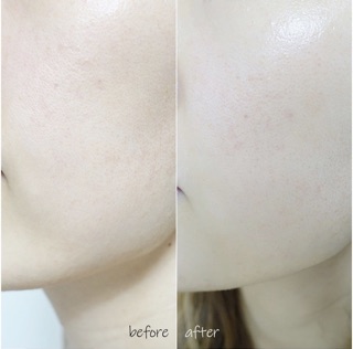 AMOREPACIFIC Vintage Single Extract Essence เอสเซนส์ต่อต้านริ้วรอยแห่งวัย มอบพลังต้านอนุมูลอิสระของสารสกัดจากใบชา ปรับสมดุลผิว และช่วยในเรื่องการอักเสบของผิว กระชับรูขุมขน ให้ผิวนุ่มชุ่มชื้น สุขภาพดี
