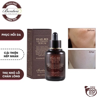 Tinh Chất Phục Hồi Da, Chống Lão Hóa Chiết Xuất Ốc Sên Hàn Quốc Benton Snail Bee Ultimate Serum 35ml
