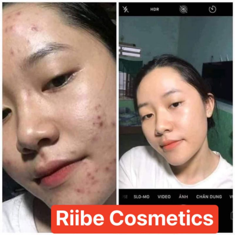 SERUM RIIBE  tặng 30ml sữa rửa mặt riibe +quà