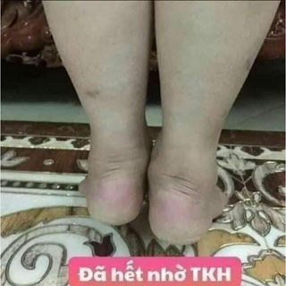 THẢO MỘC BÔI DA TKH