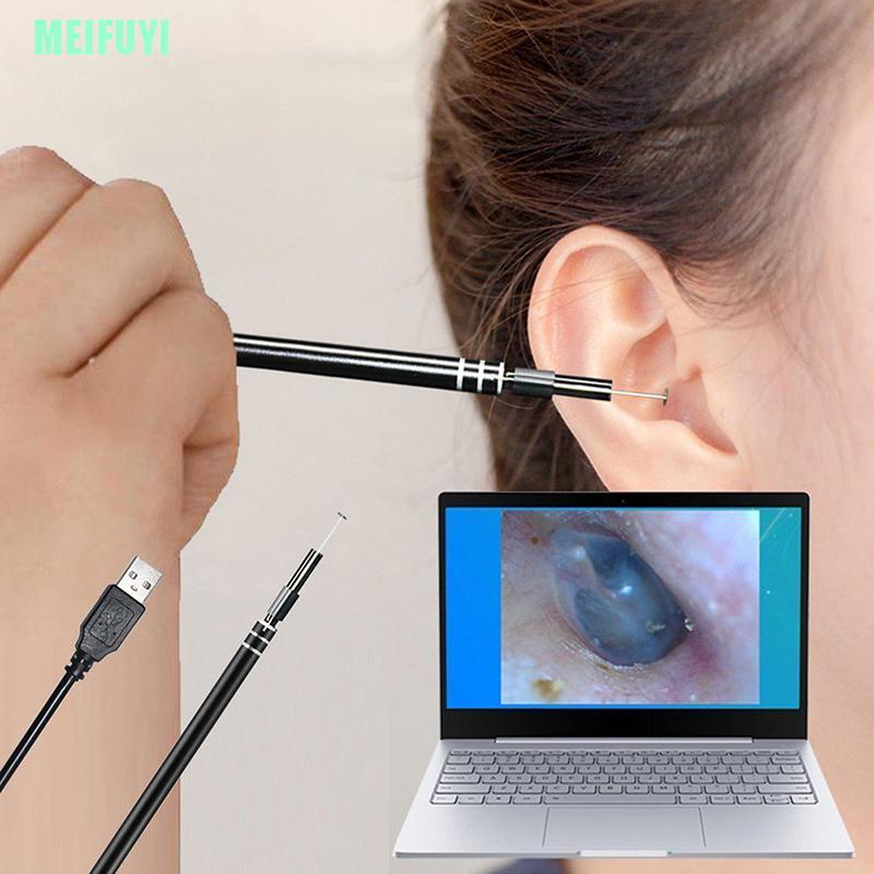 Camera Vệ Sinh Tai Cổng Usb Kèm Cây Lấy Ráy Tai Chất Lượng Cao