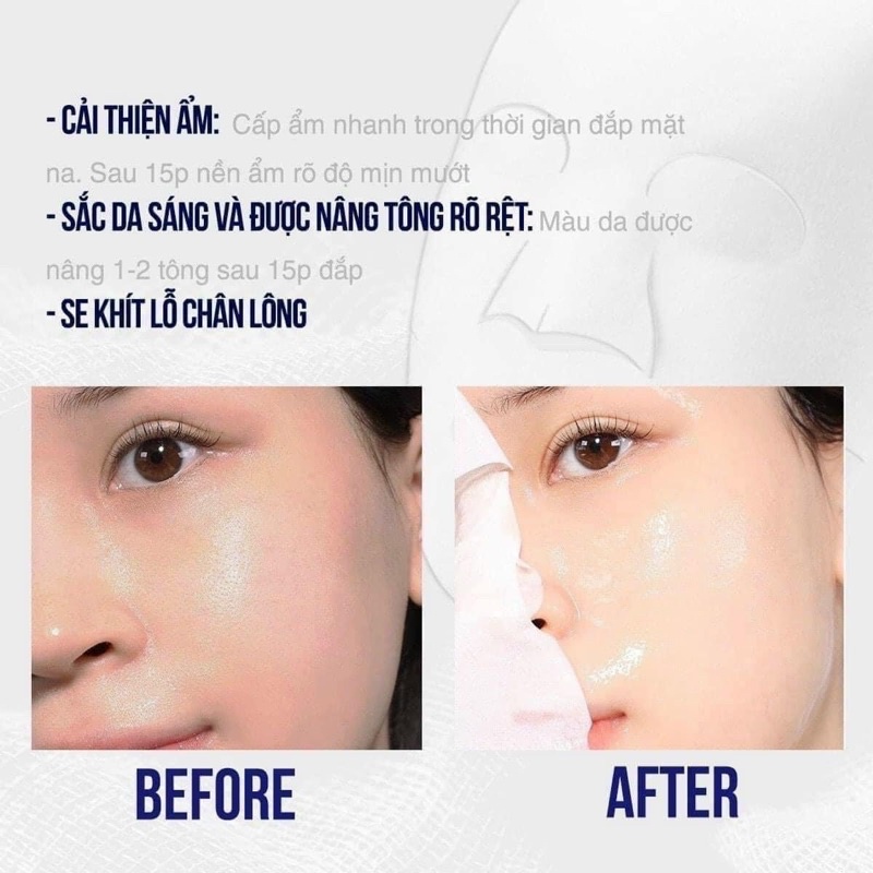 Mặt Nạ Làm Trắng Chuyên Sâu Sur.Medic mẫu mới (hộp 10 mask)