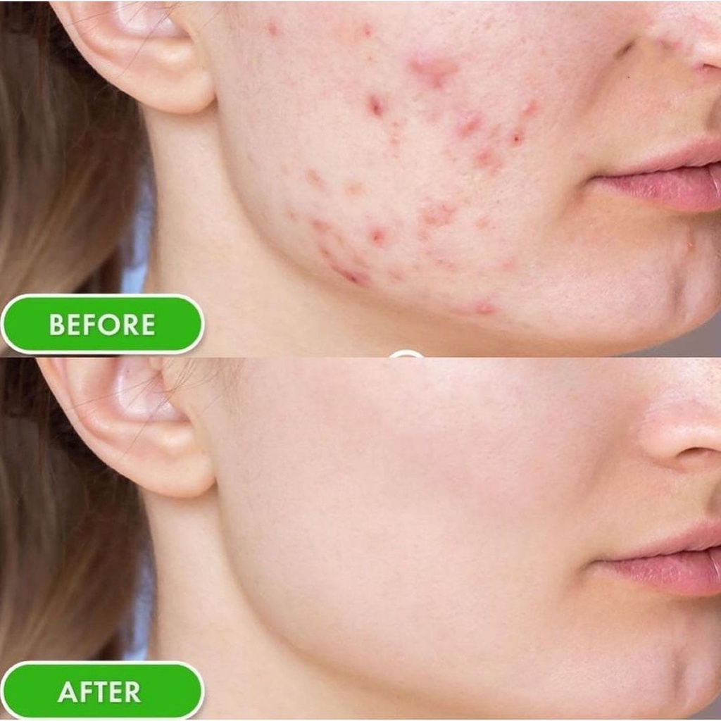 Kem dưỡng da SVR làm giảm mụn, thông thoáng lỗ chân lông và giúp loại bỏ dầu cho da Sebiaclear Mat + Pores 40ml SVR004