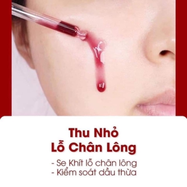 Tinh chất tái tạo da Red Peel Tingle Serum 35ml, Serum peel da hóa học RED PEEL TINGLE SERUM