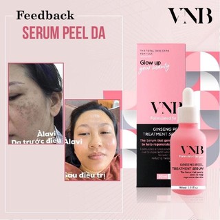 [combo ] serum peel da dạng nhẹ vnb