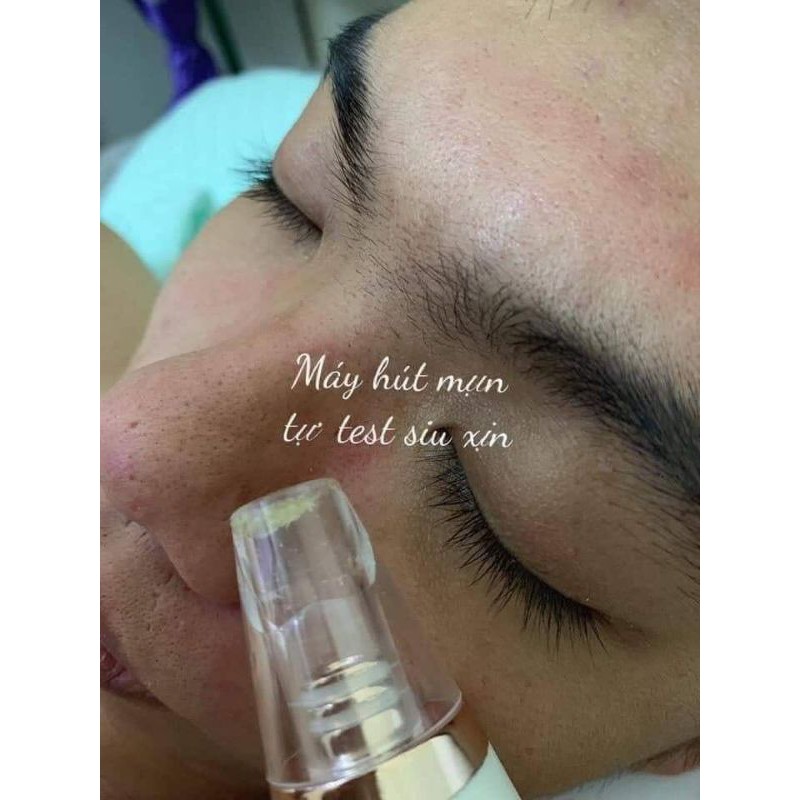 Máy hút mụn Black head cầm tay